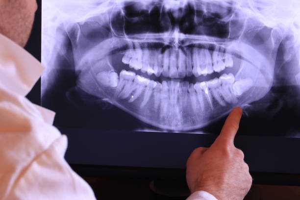 Best Broken or Cracked Tooth Emergency Dentist in Diberville, MS