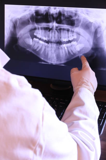 Best Emergency Root Canal Treatment in Diberville, MS
